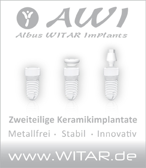 Zweiteilige AWI Implantate